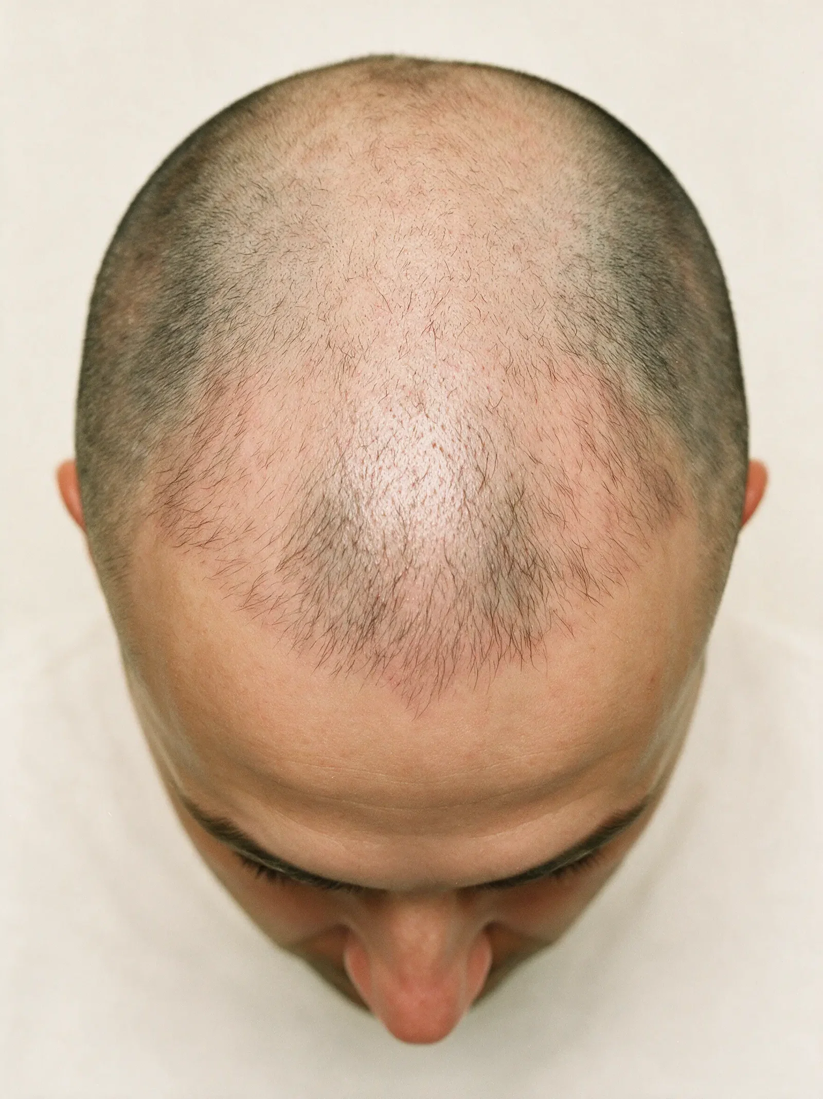 3–5 months