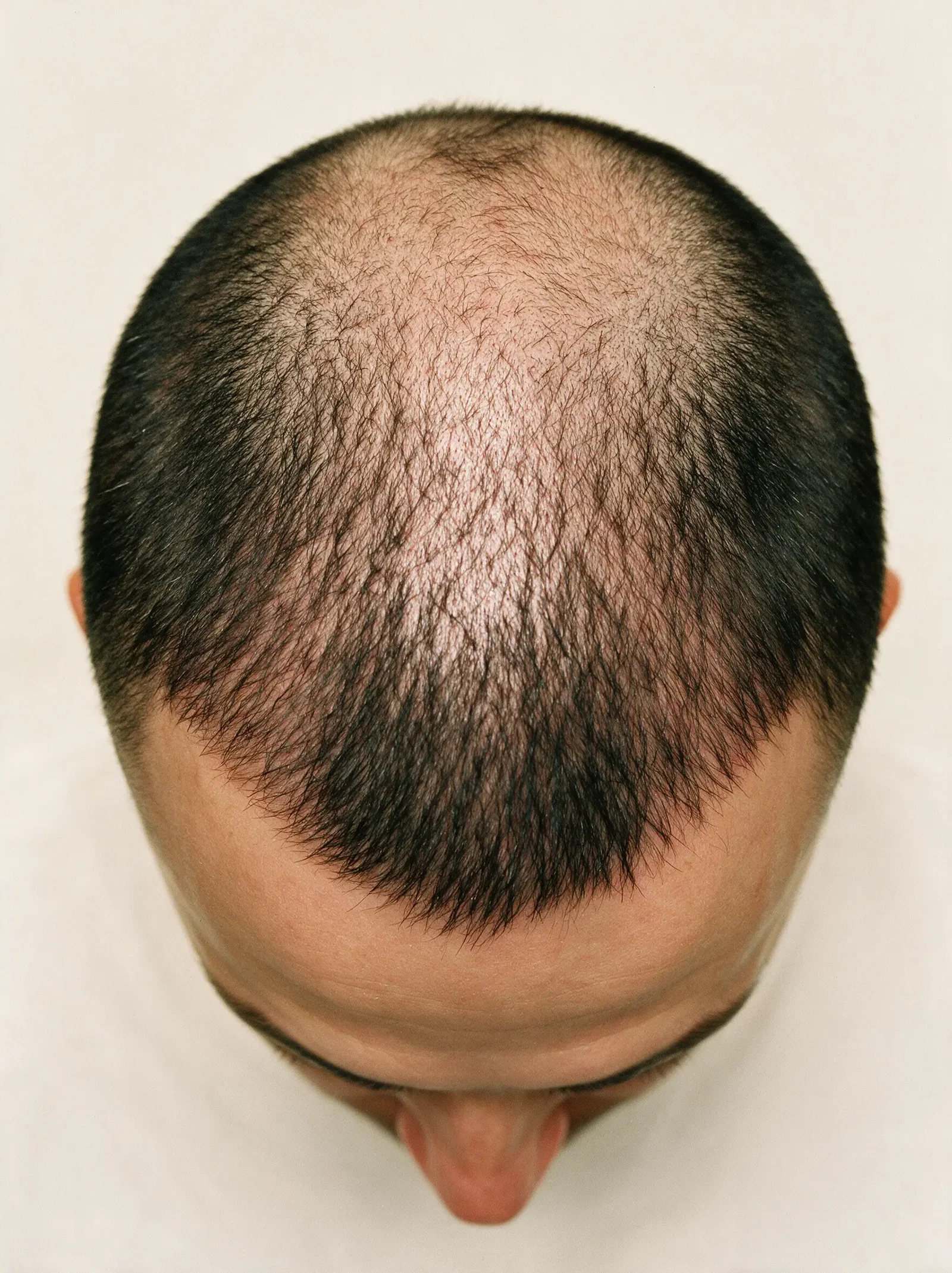 6–9 months