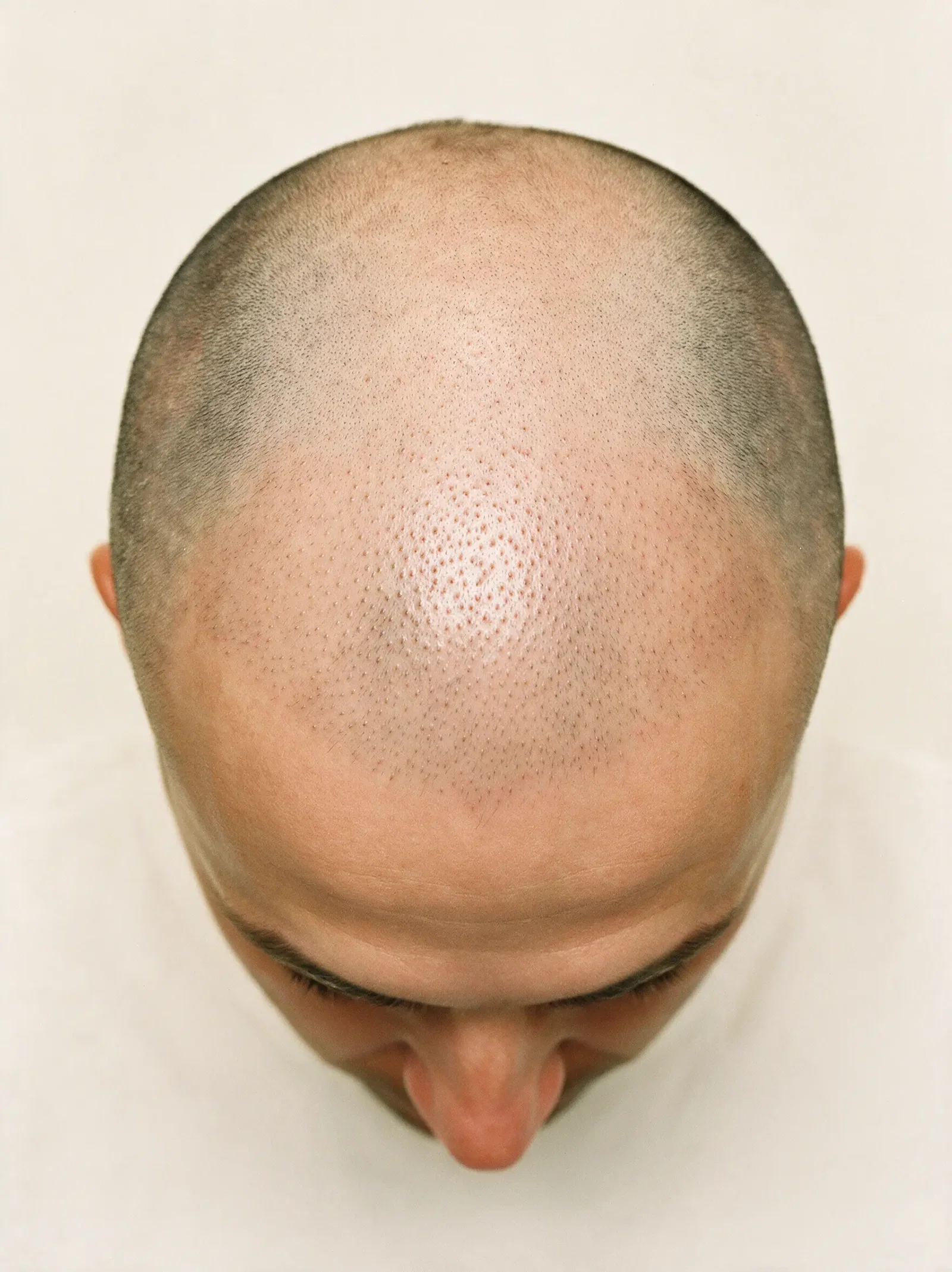 2–8 weeks